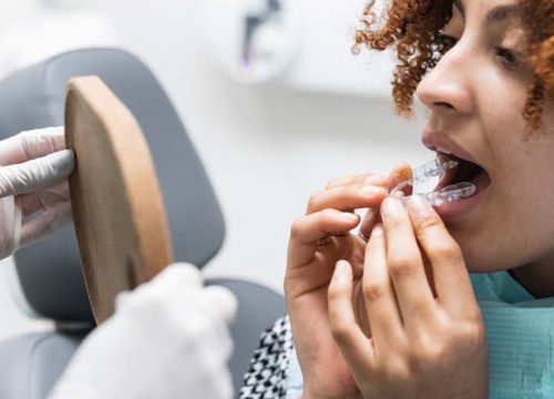 Zahnarztpraxis Dr. Dautzenberg – Aligner Zahnarztpraxis Dr. Dautzenberg - Aligner